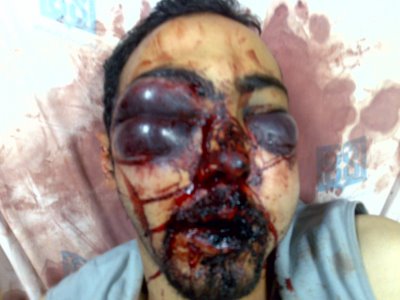 Beaten up.jpg